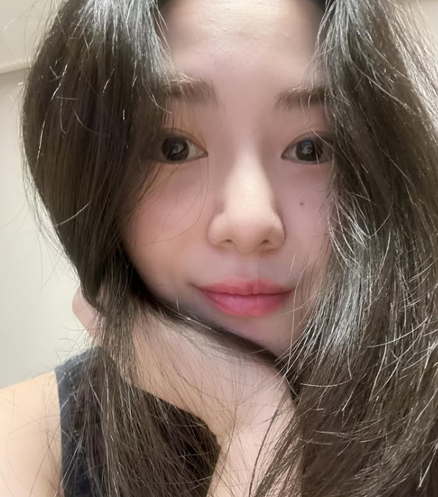 元旦才輕生被救回！知名女星「再遇事故臉部毀容」　崩潰還原過程：「感受撕裂般疼痛...」