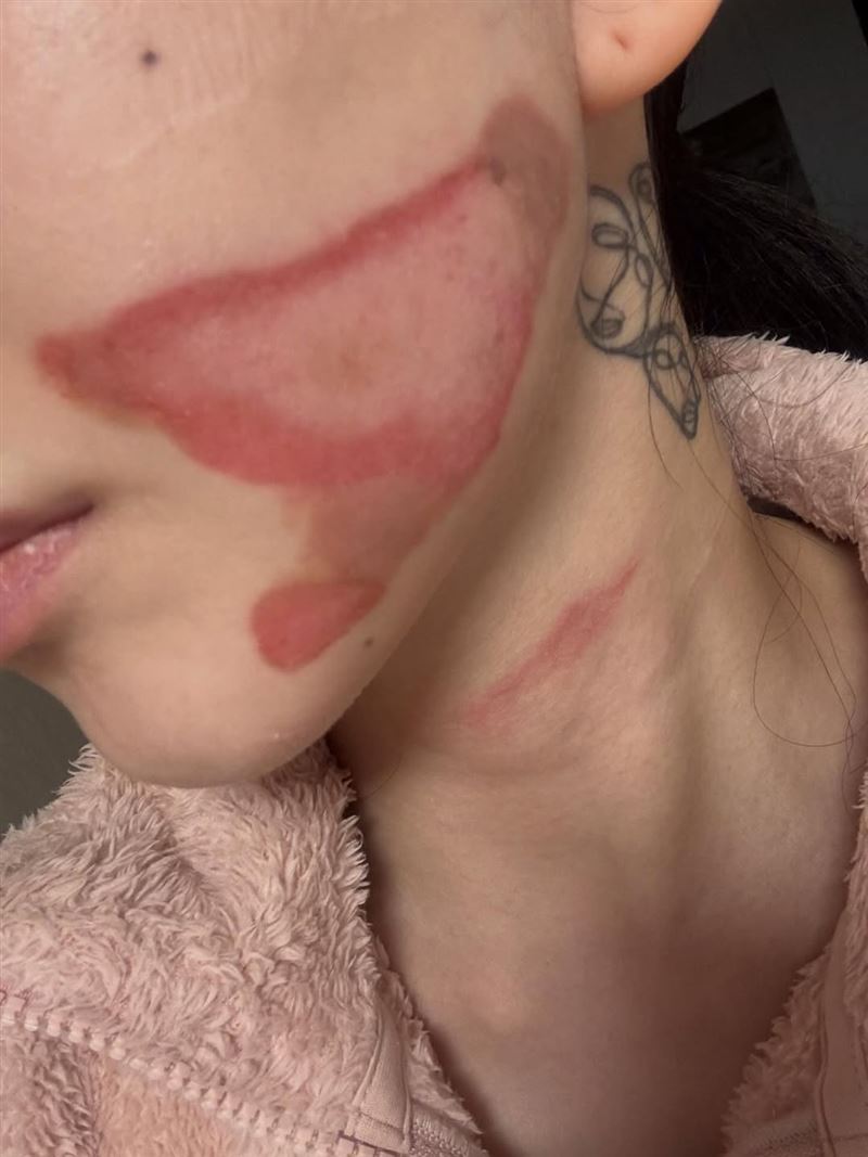 元旦才輕生被救回！知名女星「再遇事故臉部毀容」　崩潰還原過程：「感受撕裂般疼痛...」