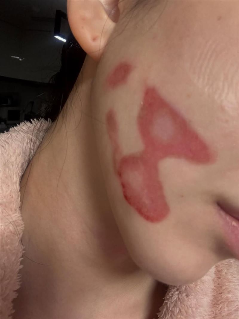 元旦才輕生被救回！知名女星「再遇事故臉部毀容」　崩潰還原過程：「感受撕裂般疼痛...」