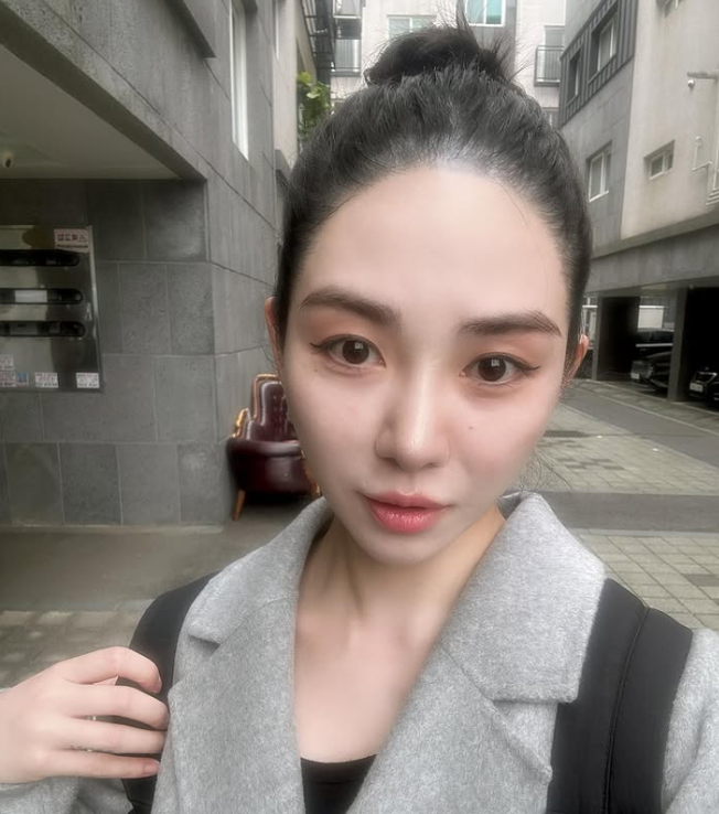 元旦才輕生被救回！知名女星「再遇事故臉部毀容」　崩潰還原過程：「感受撕裂般疼痛...」