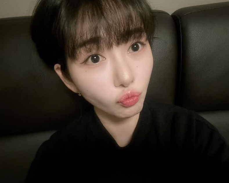 元旦才輕生被救回！知名女星「再遇事故臉部毀容」　崩潰還原過程：「感受撕裂般疼痛...」