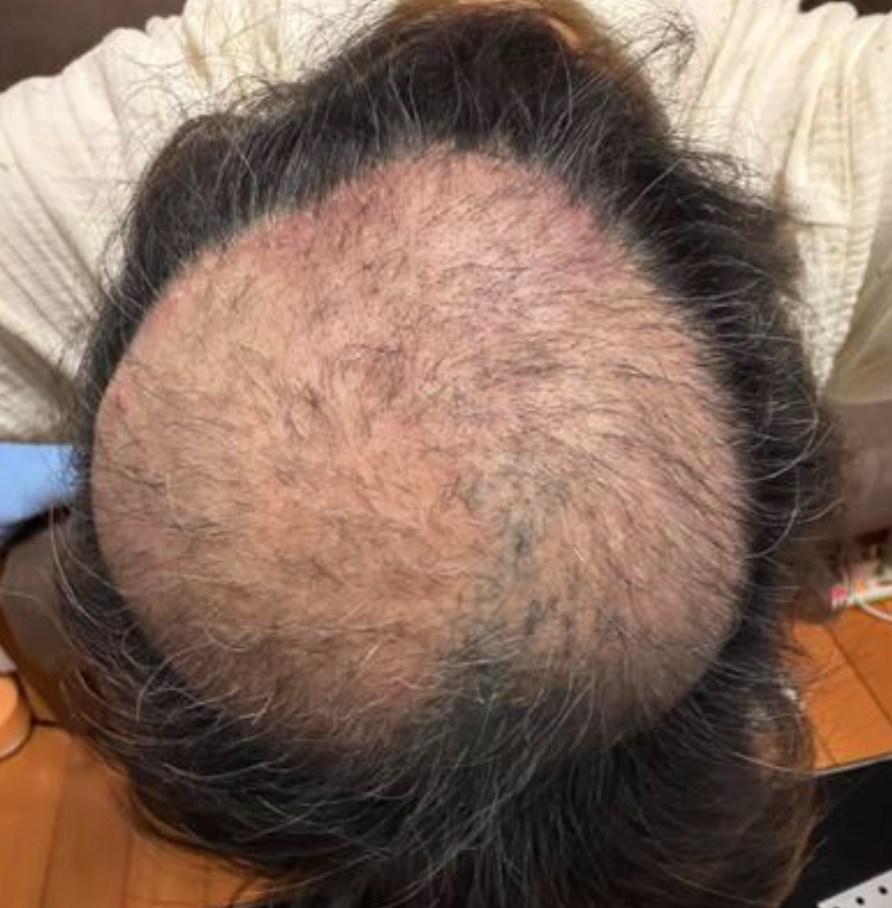 插旗台北市！臭豆腐名店「臭到飄屎味」　住戶崩潰「頭髮拔禿一片」