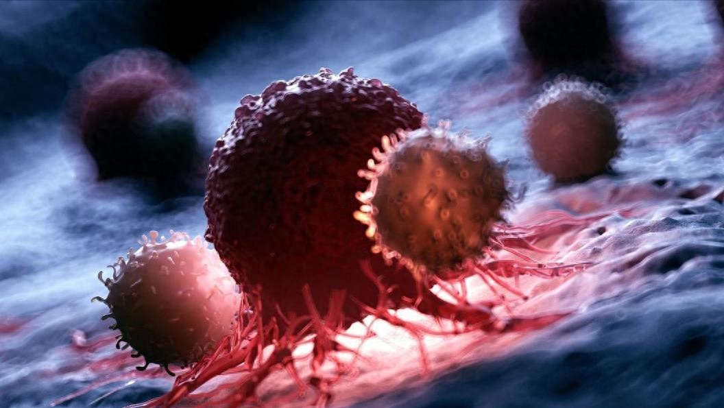 癌症不是突然出現！專家曝前半年「反覆有這些訊號」