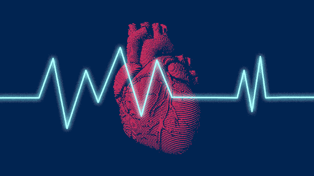 醫生：「降低壞膽固醇」的食物，這3種效果最好！