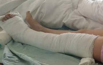 愛心補品變奪命毒湯?65歲男跌倒骨裂「妻天天熬一湯進補」 2週後送醫「腎病變末期」醫嚇傻