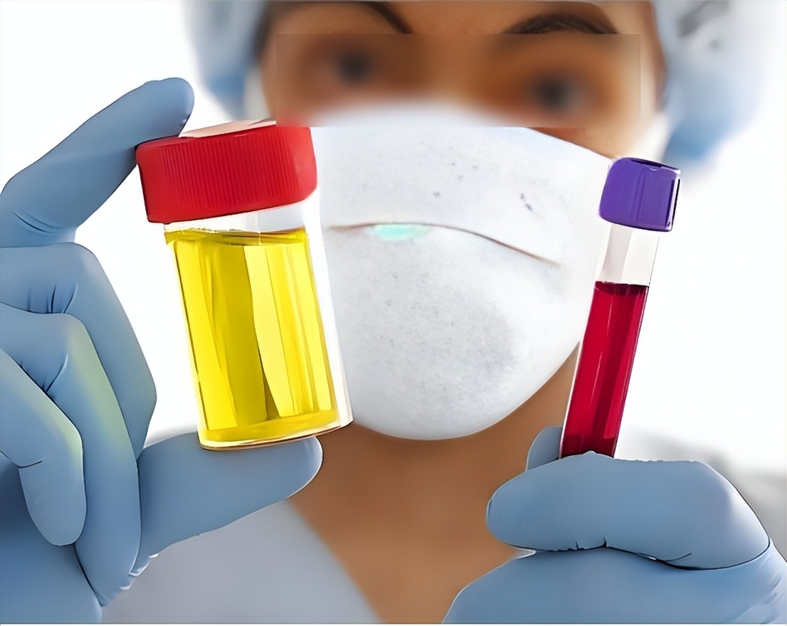 腎臟開始衰竭的信號！醫生認了「喝水後馬上出現」