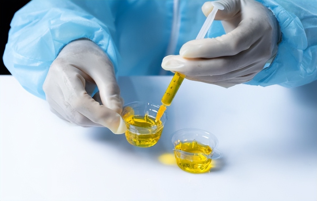 腎臟開始衰竭的信號！醫生認了「喝水後馬上出現」