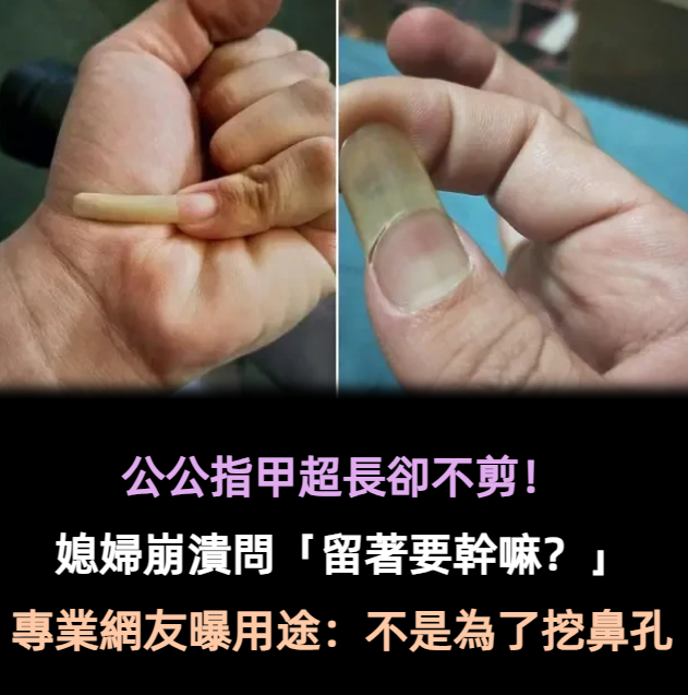 公公指甲超長卻不剪!媳婦崩潰「到底留著要幹嘛?」 專業網友給出解釋「不是為了挖鼻孔」