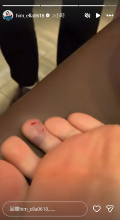 快訊／44歲Ella「開工慘濺血」痛苦躺床畫面曝光！