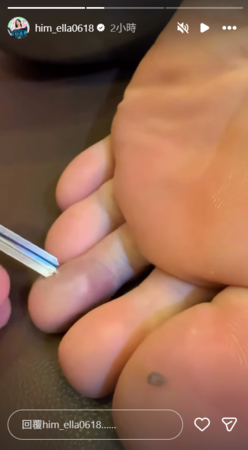 快訊／44歲Ella「開工慘濺血」痛苦躺床畫面曝光！