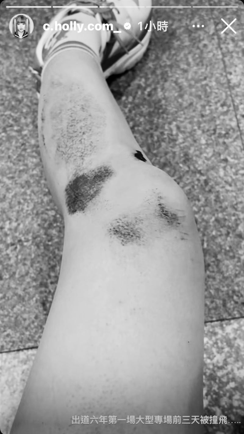 台灣女星「驚傳車禍」！傷勢嚴重緊急送醫