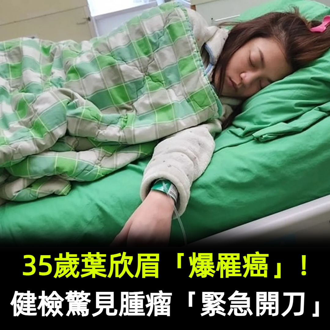 35歲葉欣眉「爆罹癌」！健檢驚見腫瘤「緊急開刀」