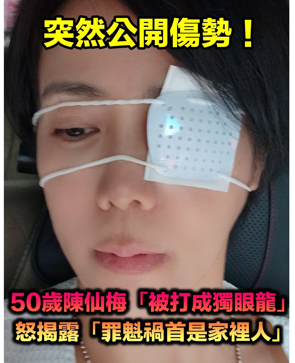 突然出事!50歲八點檔女星「變獨眼龍」傷勢嚴重 曝「罪魁禍首是家裡人」親揭老公反應