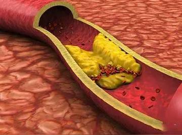 明明吃相同食物！研究證實「越晚進食會越胖」　醫警告「超過一時段」發福機率飆2.1倍