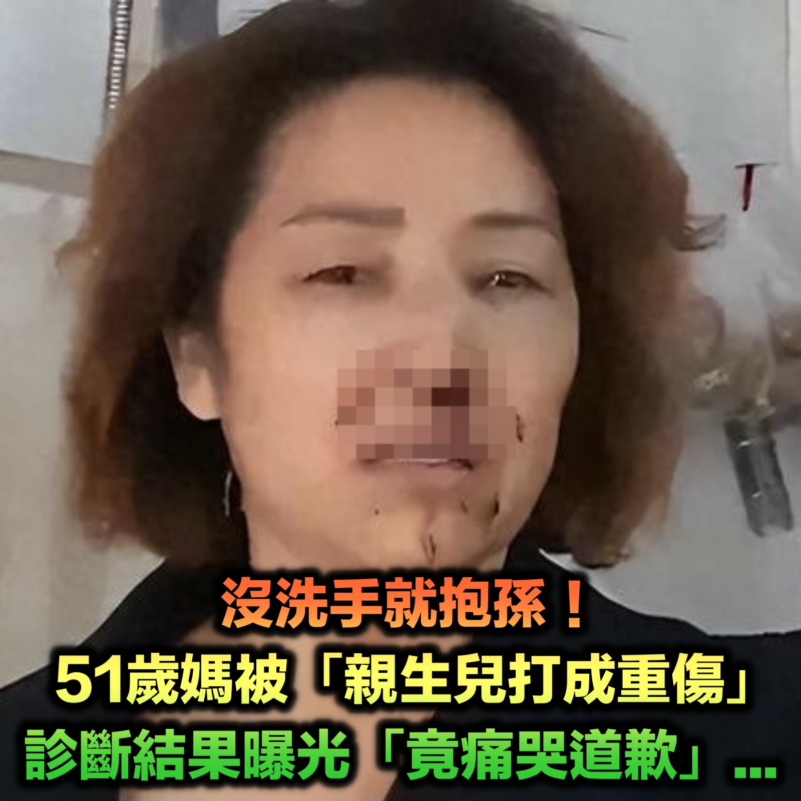 沒洗手就抱孫！51歲媽「被親生兒打成重傷」　「診斷結果倒抽一口氣」最後竟痛哭道歉...