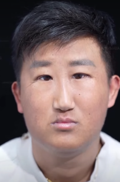 五官長超擠！他靠「超小眼睛」爆紅　下定決心「去動雙眼皮手術」成果網看呆：有差嗎