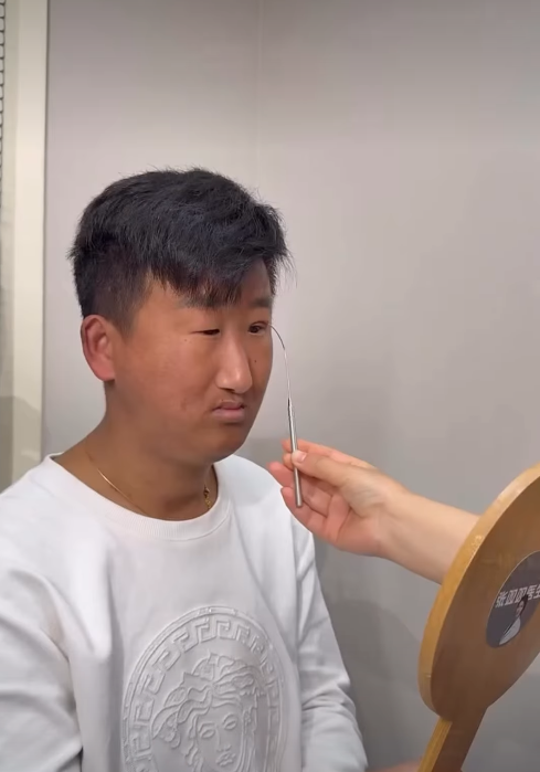 五官長超擠！他靠「超小眼睛」爆紅　下定決心「去動雙眼皮手術」成果網看呆：有差嗎