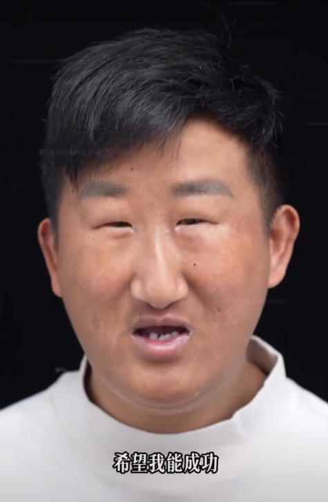 五官長超擠！他靠「超小眼睛」爆紅　下定決心「去動雙眼皮手術」成果網看呆：有差嗎