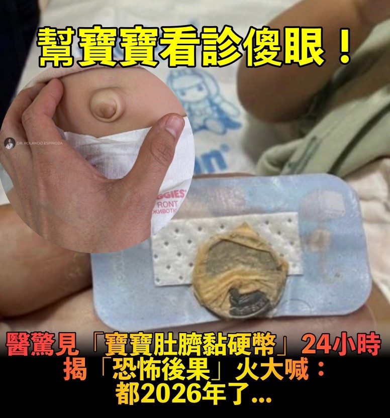 肚臍凸凸的!醫生驚見寶寶「肚臍被貼硬幣24小時」 長輩說能壓平「醫揭恐怖後果」氣炸