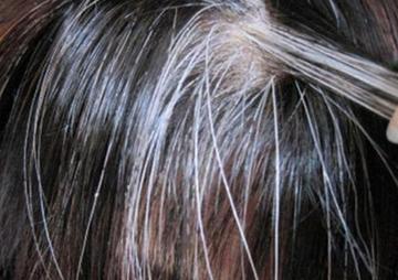 還未滿40歲白髮就狂冒！營養師揭「不是老化造成」　點名「缺6大營養素」吃對頭髮就能黑回來