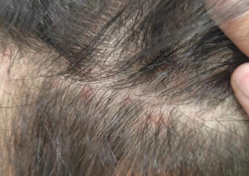 毒洗髮精被曝光！正在傷害你的頭皮「一堆家庭還在用」