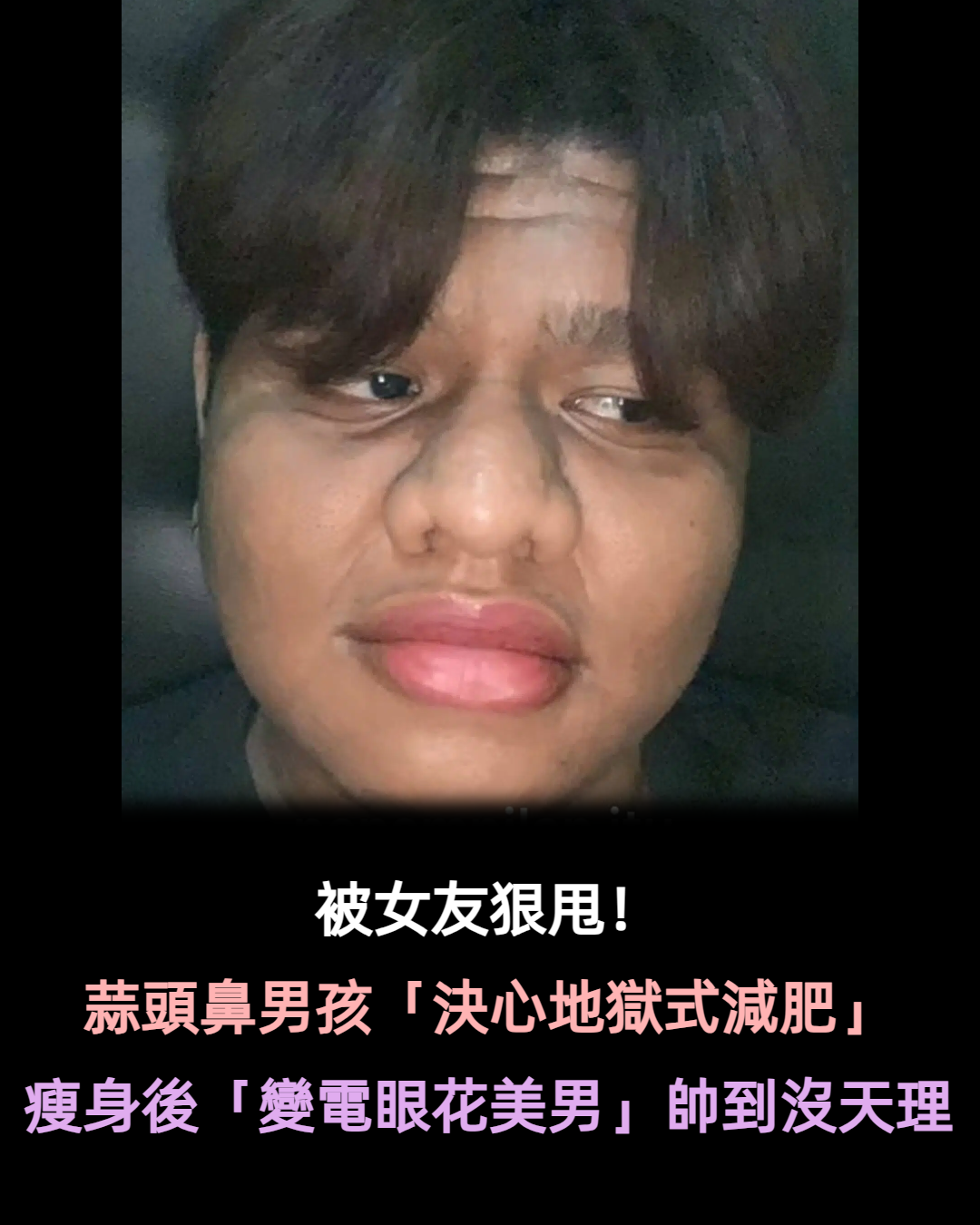 黝黑胖男孩「慘被女友狠甩」決心地獄式減肥　成功瘦身後「變成花美男歐巴」1700萬人驚嘆太強