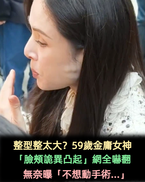 遭疑整型後遺症！57歲女神「臉頰出現詭異凸起」網酸：動過臉嗎　無奈揭真相「竟是怪病纏身」