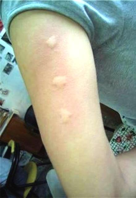 睡覺被蚊子吵到崩潰！她分享「免花錢滅蚊法」　網友照做「5分鐘殺3隻」大推：比捕蚊燈還有用