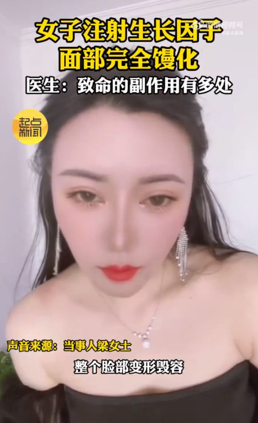 醫美大失敗!她臉部腫脹「直接變麵包超人」 曬出「原本精緻美貌」崩潰:根本不敢照鏡子