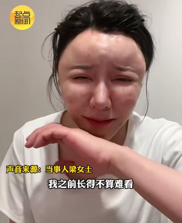 醫美大失敗!她臉部腫脹「直接變麵包超人」 曬出「原本精緻美貌」崩潰:根本不敢照鏡子
