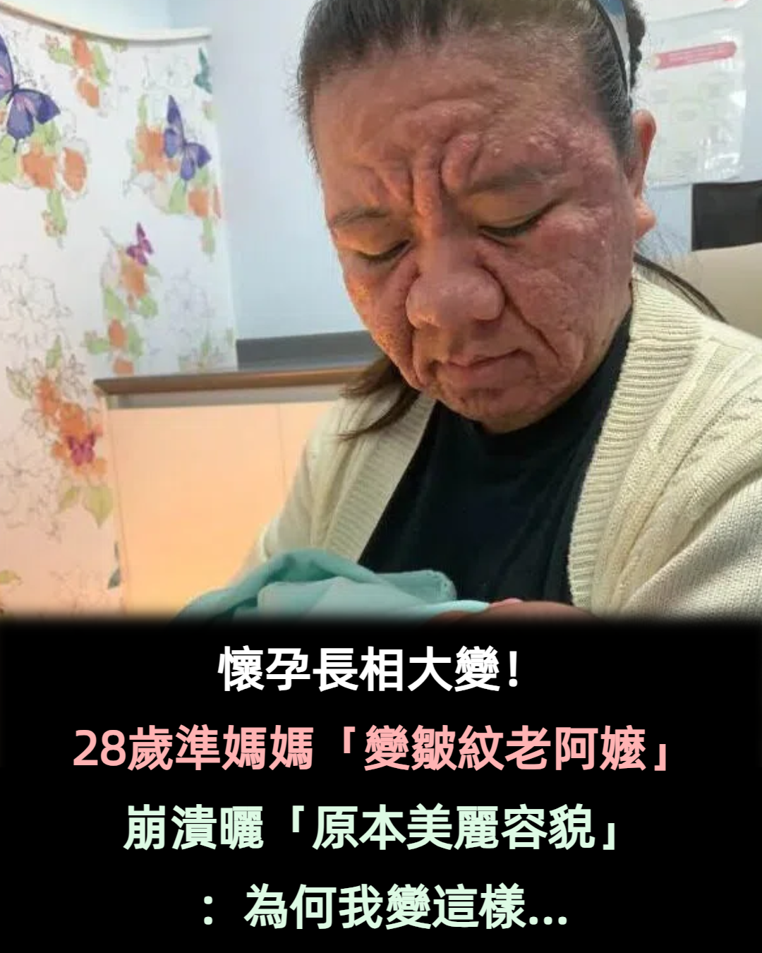 因懷孕容貌大變！28歲準媽媽崩潰「變成60歲阿嬤」　公開「原本清秀模樣」：為什麼是我...