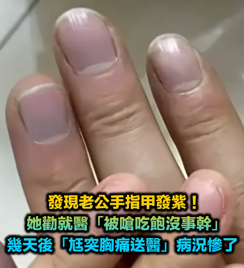 被嗆吃飽沒事幹!她發現「老公手指甲發紫」勸就醫遭拒 幾天後「尪突胸痛送醫」醫曝病況:再晚就慘了