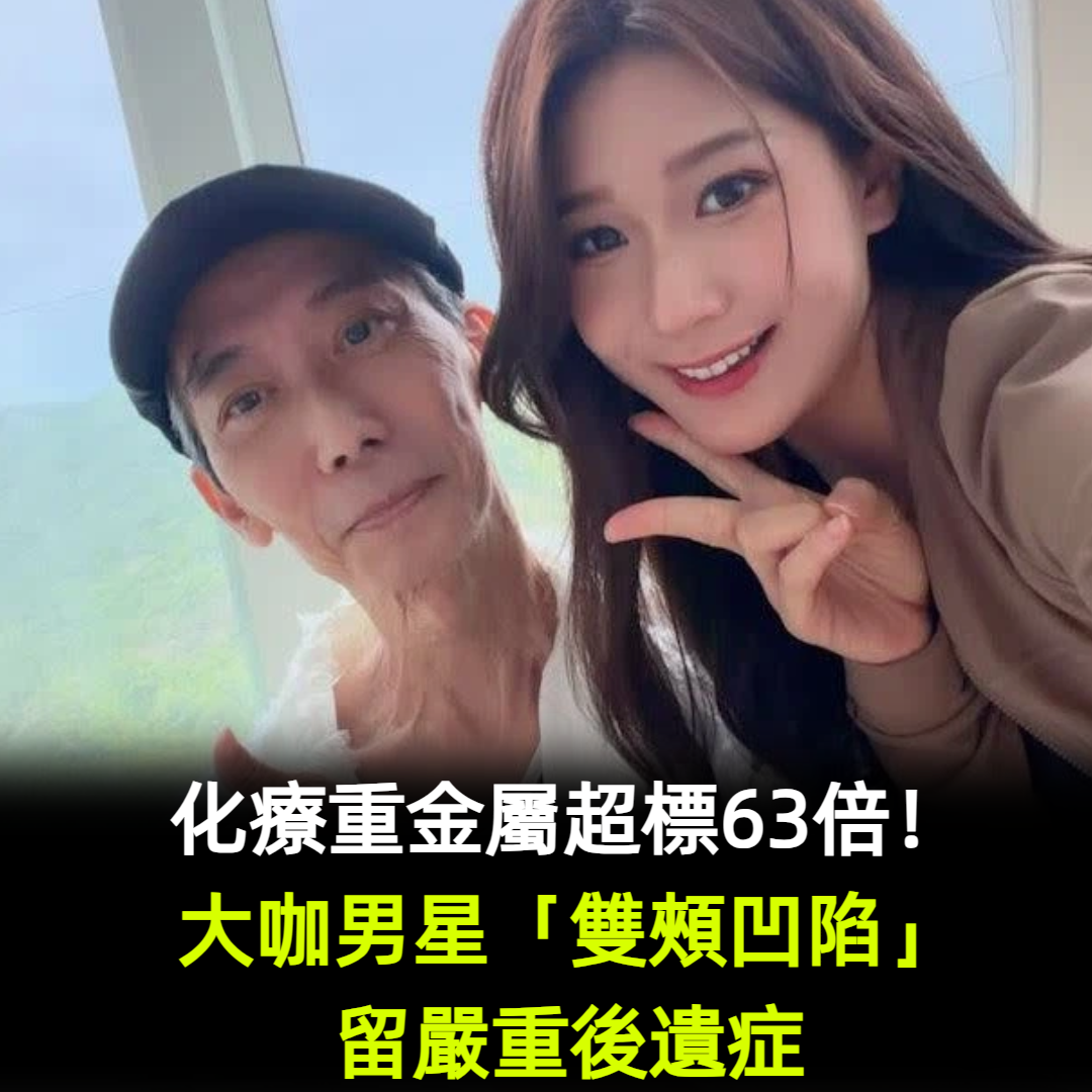 化療重金屬超標63倍!大咖男星「雙頰凹陷」留嚴重後遺症