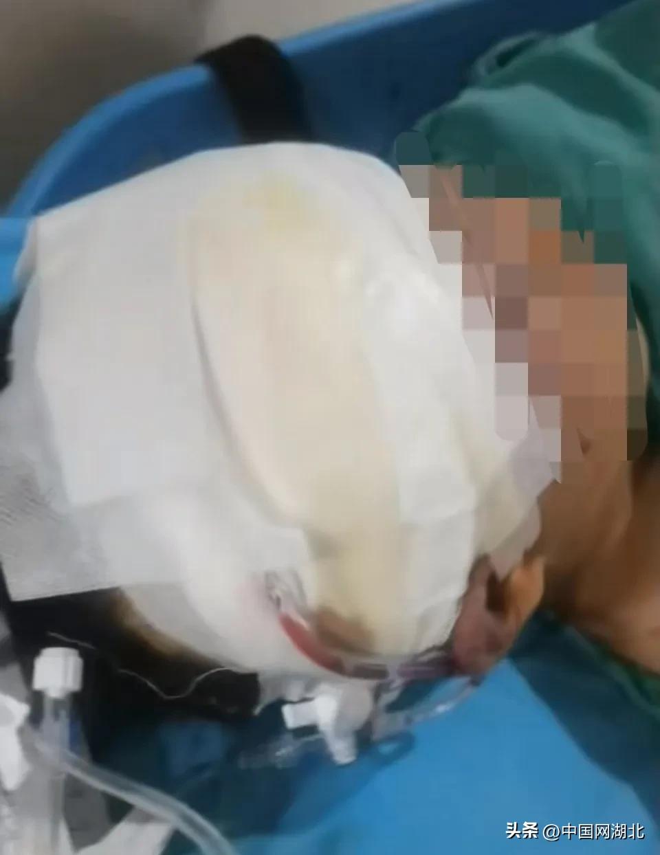 太愛翹課!13歲男童「被送進教育營」...竟遭「打斷骨失明」對方回應了