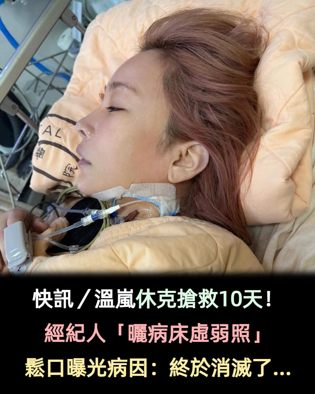 快訊／溫嵐休克搶救10天！經紀人「曬病床虛弱照」　鬆口曝光病因：終於消滅了...