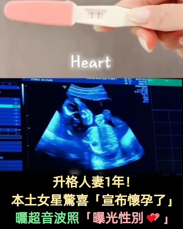 升格人妻1年！本土女星驚喜「宣布懷孕了」　曬超音波照「曝光性別」：謝謝選擇我