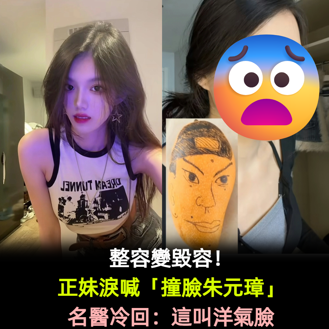 整容變毀容！正妹淚喊「撞臉朱元璋」名醫冷回：這叫洋氣臉