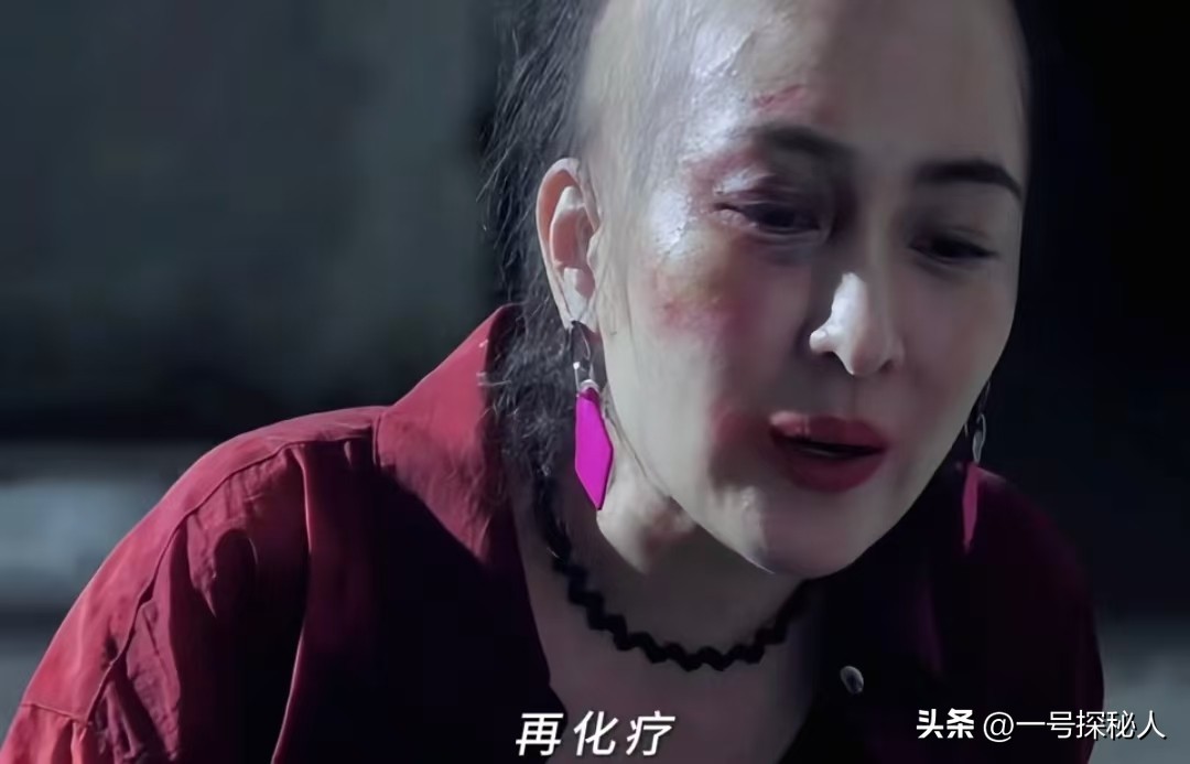 因外遇醜聞淡出！45歲女星被目擊「剃光頭形象全毀」　「竟與化療有關」網拍手叫好...