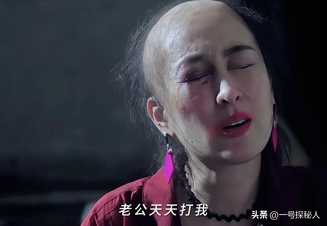 因外遇醜聞淡出！45歲女星被目擊「剃光頭形象全毀」　「竟與化療有關」網拍手叫好...