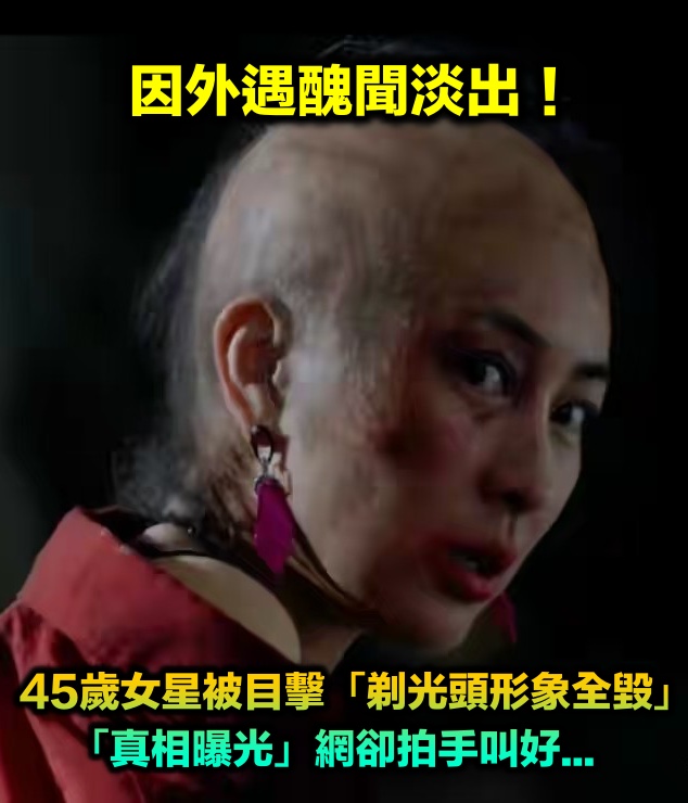 因外遇醜聞淡出！45歲女星被目擊「剃光頭形象全毀」　「竟與化療有關」網拍手叫好...
