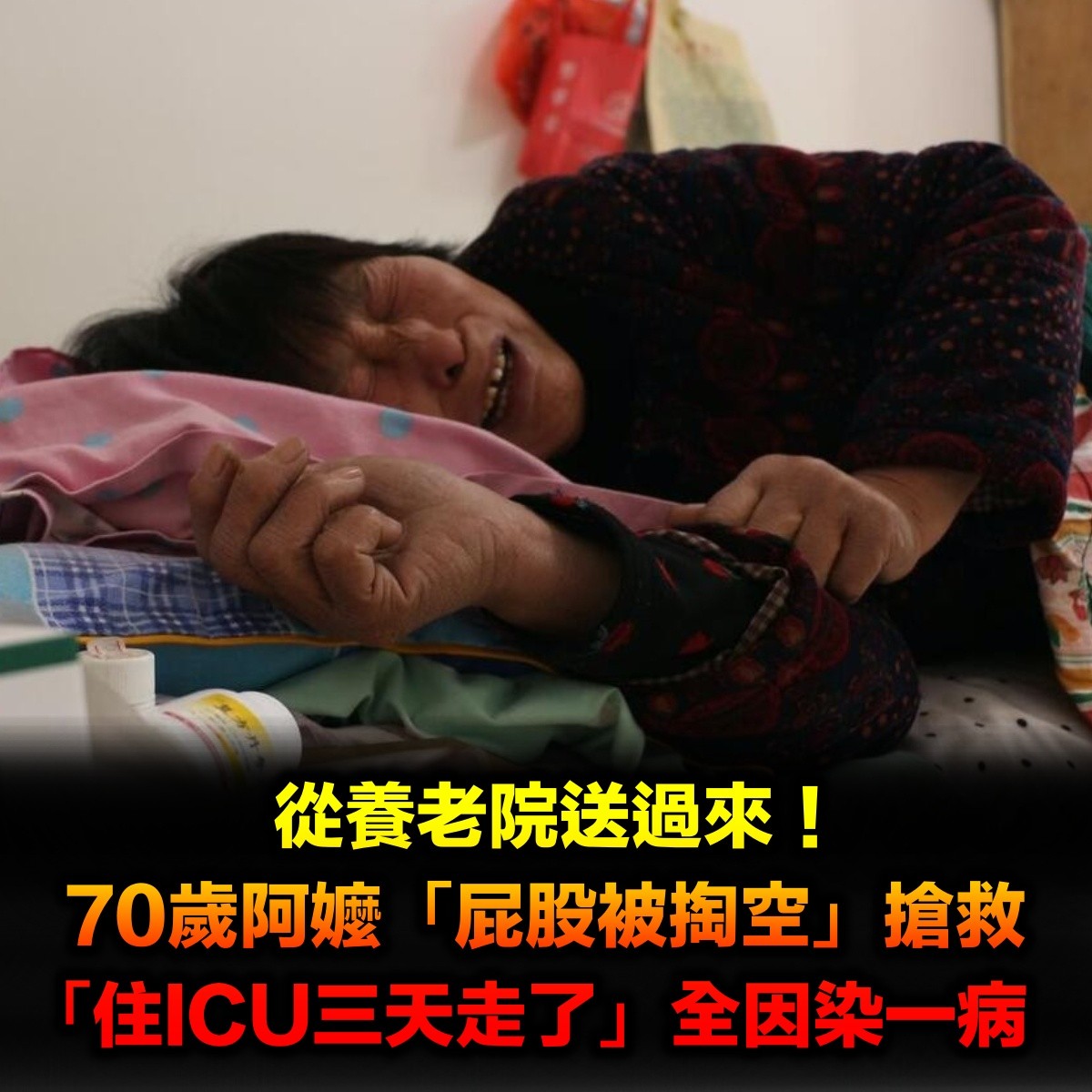 從養老院送過來!70歲老太太「屁股被掏空」醫嚇壞 「住ICU三天死亡」全因染一病