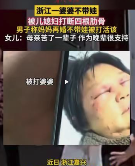 退休想享清福!60歲婦人「拒絕幫帶孫」遭媳婦動手 斷4根肋骨「兒子得知後續舉動」網全看傻