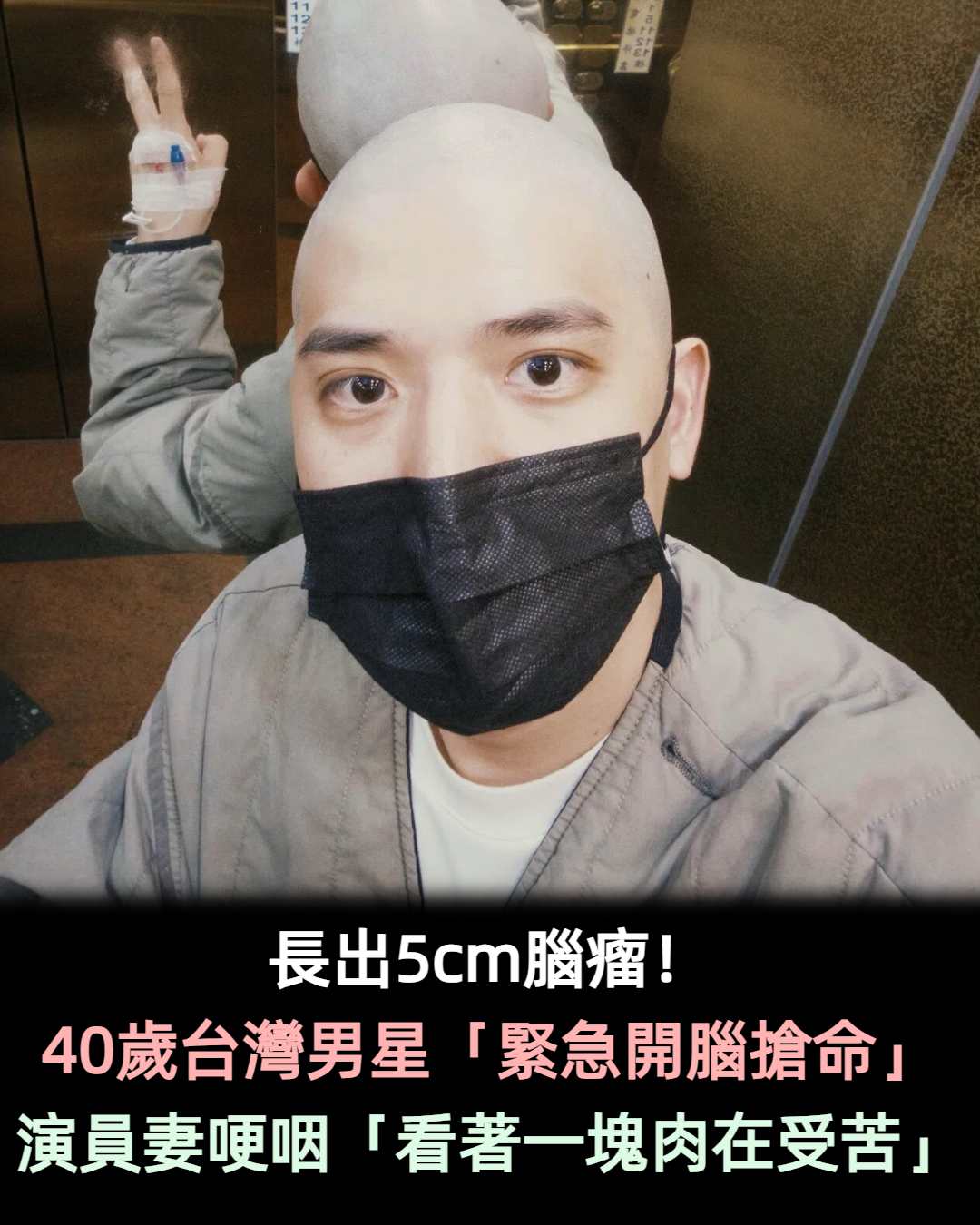 長出5cm腦瘤！40歲台灣男星「緊急開腦搶命」　 演員妻哽咽「看著一塊肉在受苦」
