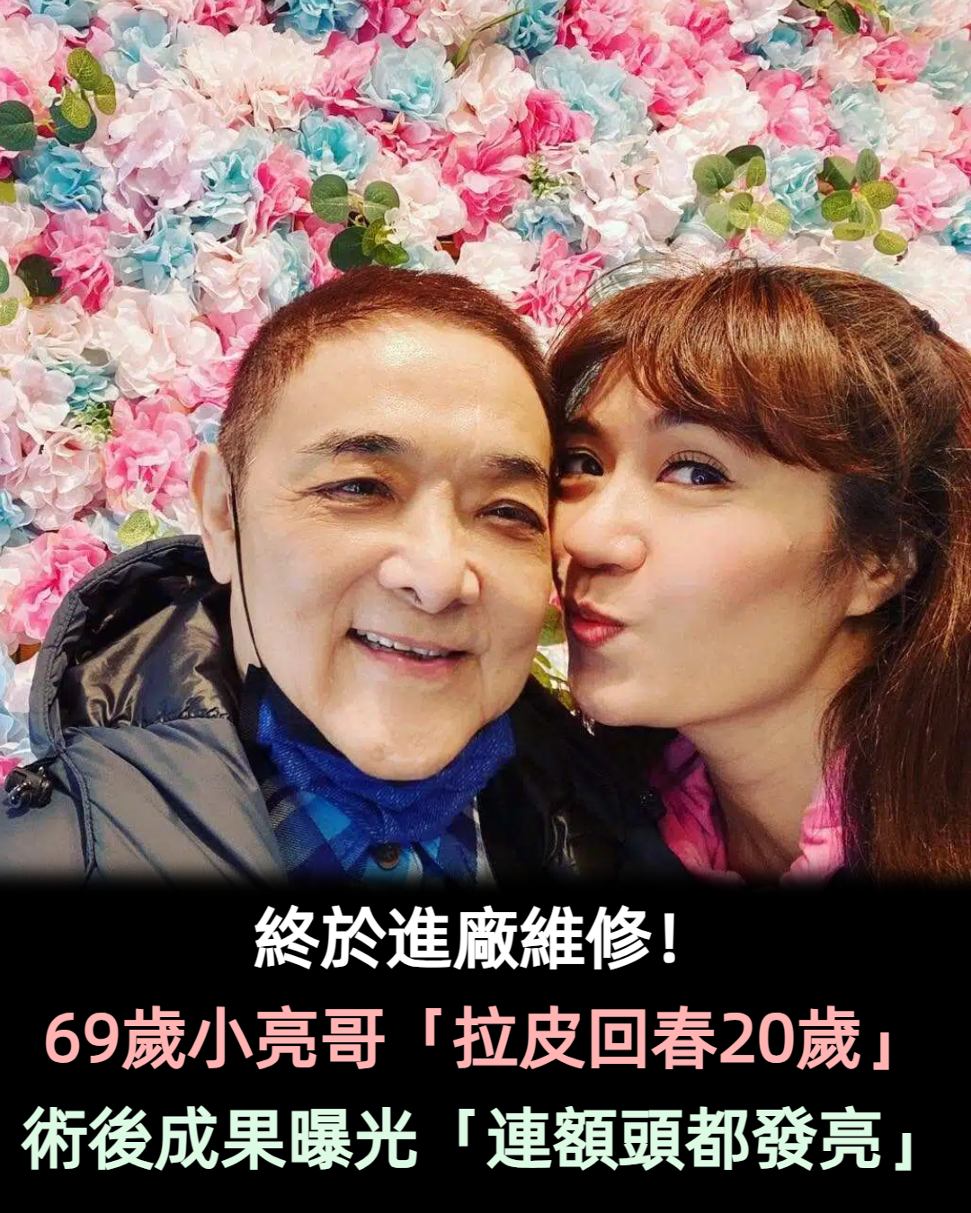 終於進廠維修！ 69歲小亮哥「拉皮回春20歲」　術後成果曝光「連額頭都發亮」