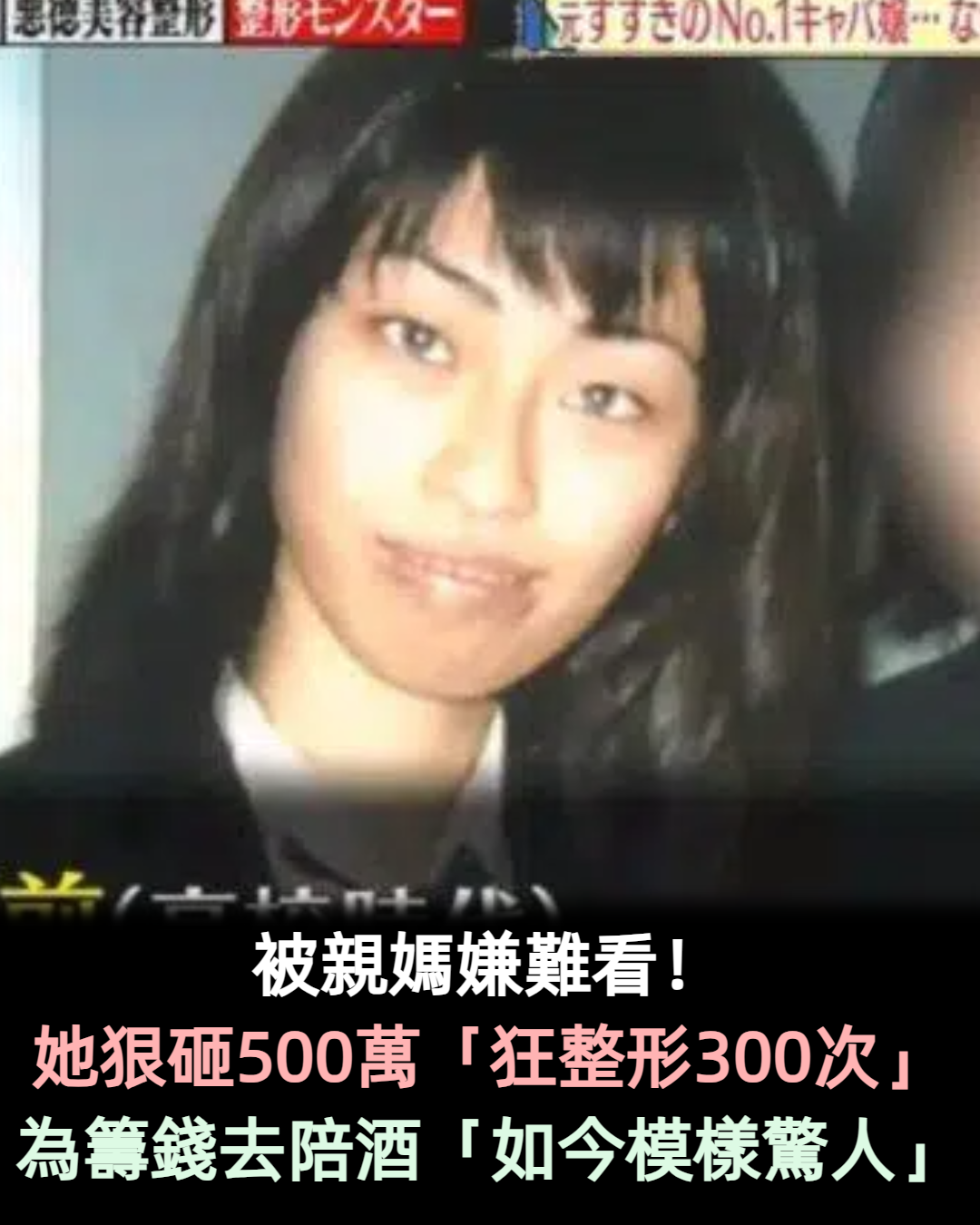 被親媽嫌難看!她狠砸500萬「狂整形300次」 為籌錢去陪酒「如今模樣驚人」