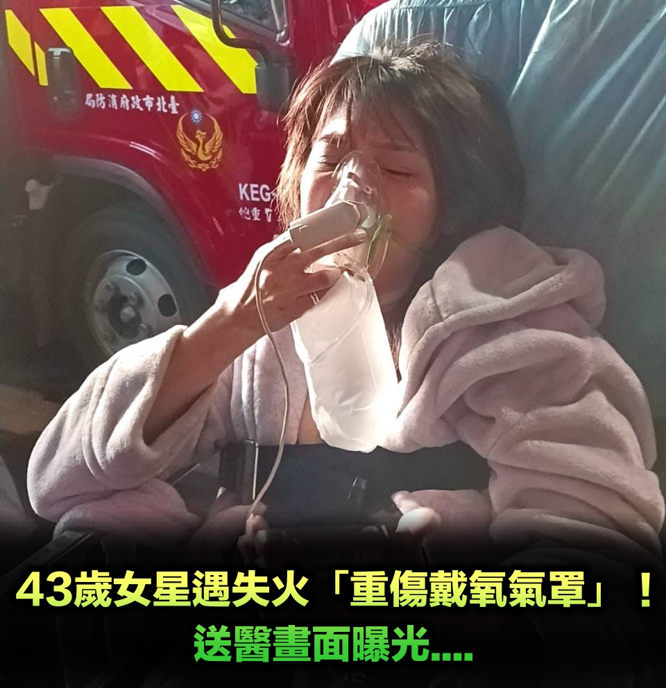 樓下突失火!43歲女星「慘遭濃煙嗆傷」險命喪火窟 「重傷戴氧氣罩」送醫畫面曝光