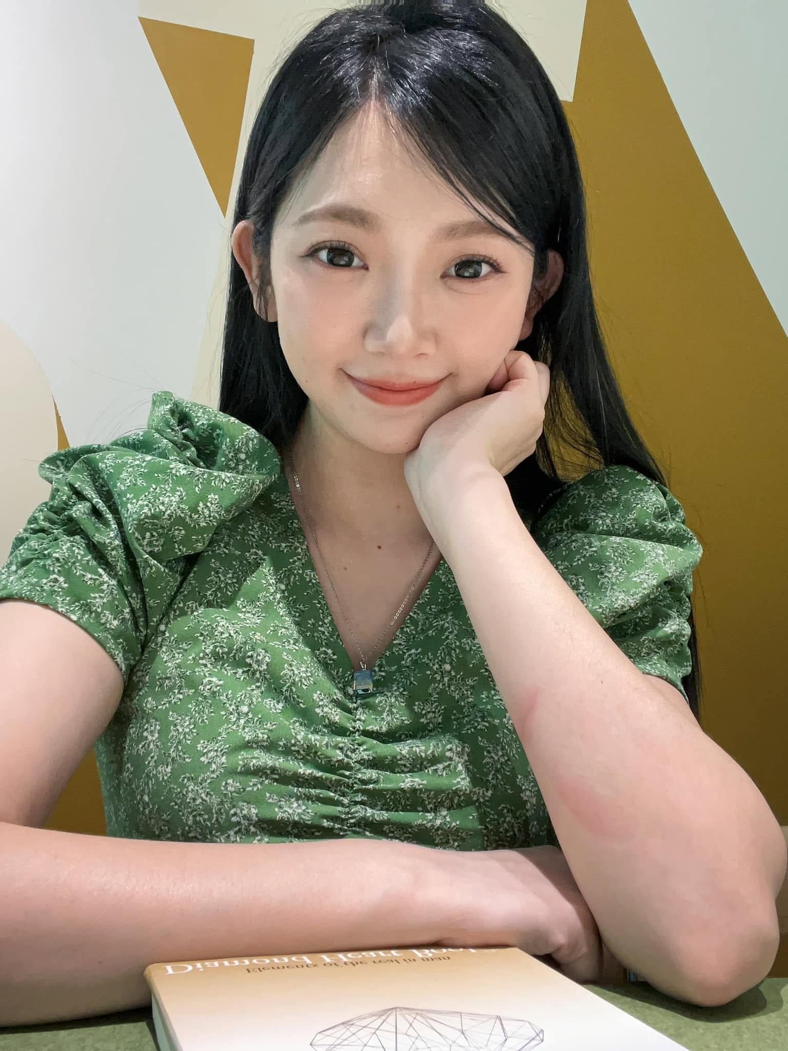 休克失去意識!37歲台灣女星「入院搶命2周」現況曝光