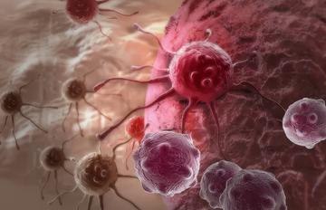 不想短命快戒掉!日常一習慣「乳癌、肺癌、血癌」5癌風險暴增:死亡機率增9%