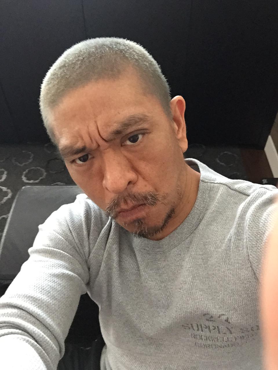 驚傳罹患大腸癌！62歲綜藝天王「裝人工肛門搶命」