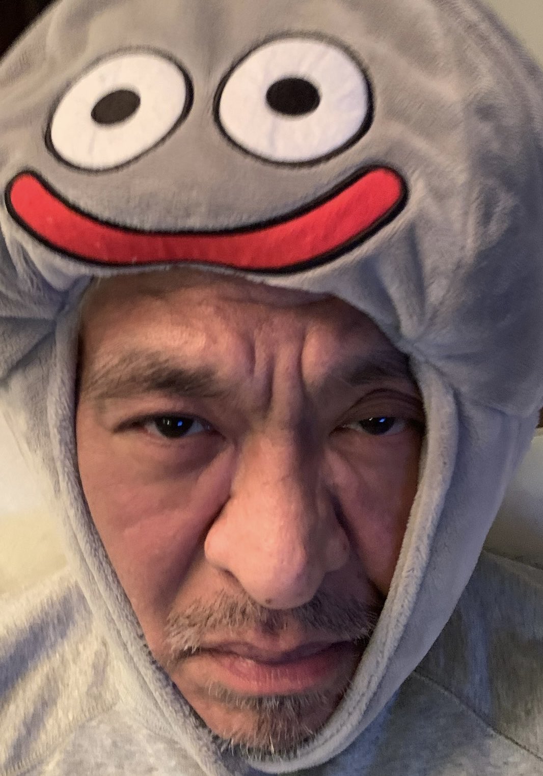 驚傳罹患大腸癌！62歲綜藝天王「裝人工肛門搶命」